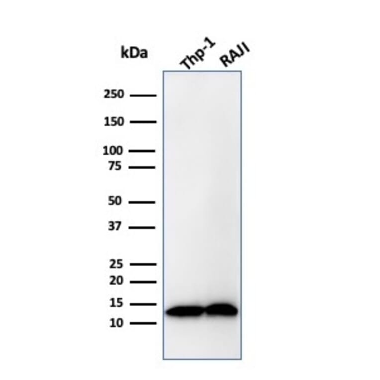 Western Blot - Anti-beta 2 Microglobulin Antibody [B2M/1857R] - BSA and Azide free (A252934) - Antibodies.com