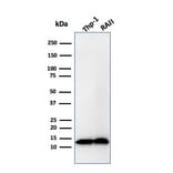 Western Blot - Anti-beta 2 Microglobulin Antibody [B2M/1857R] - BSA and Azide free (A252934) - Antibodies.com
