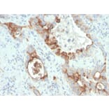Immunohistochemistry - Anti-PMEPA1 Antibody [rPMEPA1/6422] - BSA and Azide free (A252934) - Antibodies.com