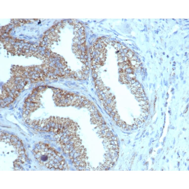 Immunohistochemistry - Anti-PMEPA1 Antibody [rPMEPA1/6422] - BSA and Azide free (A252935) - Antibodies.com