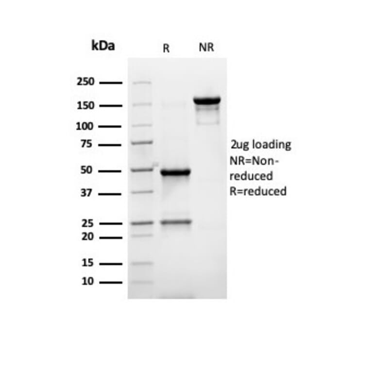 SDS-PAGE - Anti-PMEPA1 Antibody [rPMEPA1/6422] - BSA and Azide free (A252935) - Antibodies.com