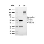 SDS-PAGE - Anti-PMEPA1 Antibody [rPMEPA1/6422] - BSA and Azide free (A252935) - Antibodies.com