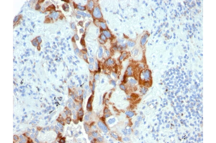 Immunohistochemistry - Anti-PMEPA1 Antibody [PMEPA1/2696] - BSA and Azide free (A252936) - Antibodies.com