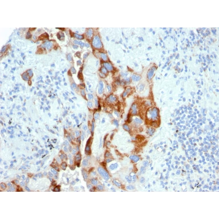 Immunohistochemistry - Anti-PMEPA1 Antibody [PMEPA1/2696] - BSA and Azide free (A252936) - Antibodies.com