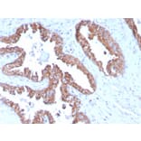 Immunohistochemistry - Anti-PMEPA1 Antibody [PMEPA1/2696] - BSA and Azide free (A252936) - Antibodies.com