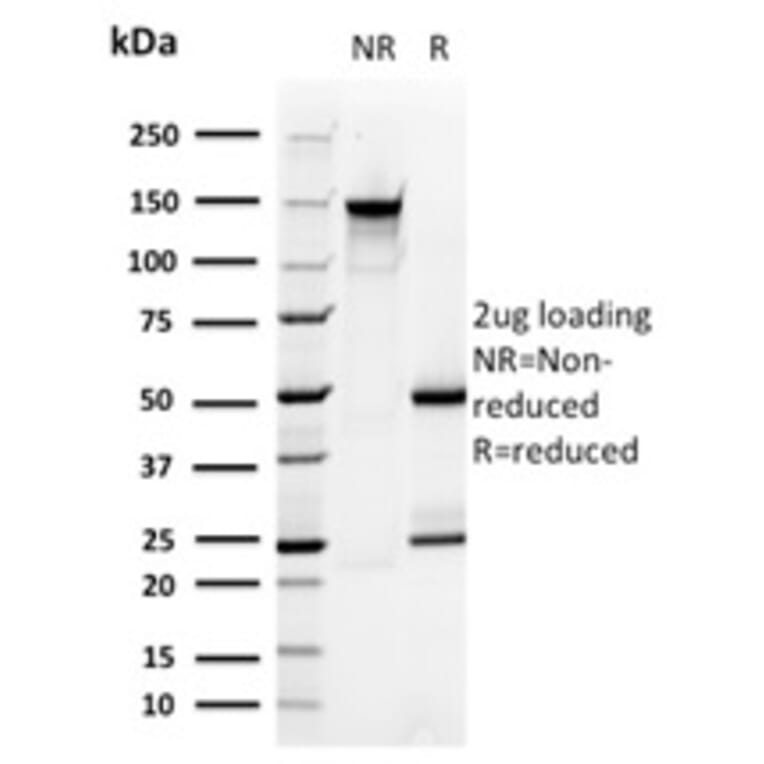 SDS-PAGE - Anti-PMEPA1 Antibody [PMEPA1/2696] - BSA and Azide free (A252936) - Antibodies.com
