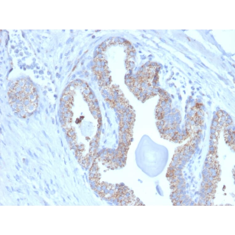 Immunohistochemistry - Anti-PMEPA1 Antibody [PMEPA1/2697] - BSA and Azide free (A252937) - Antibodies.com