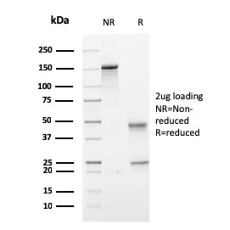 SDS-PAGE - Anti-PMEPA1 Antibody [PMEPA1/2697] - BSA and Azide free (A252937) - Antibodies.com