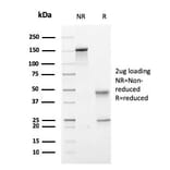 SDS-PAGE - Anti-PMEPA1 Antibody [PMEPA1/2697] - BSA and Azide free (A252937) - Antibodies.com