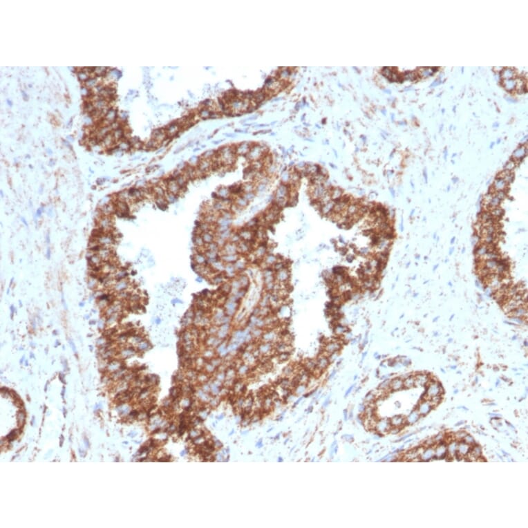 Immunohistochemistry - Anti-PMEPA1 Antibody [PMEPA1/2698] - BSA and Azide free (A252938) - Antibodies.com