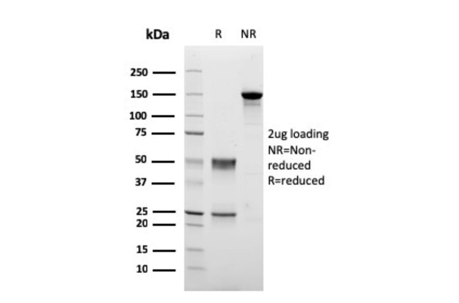 SDS-PAGE - Anti-PMEPA1 Antibody [PMEPA1/2698] - BSA and Azide free (A252938) - Antibodies.com