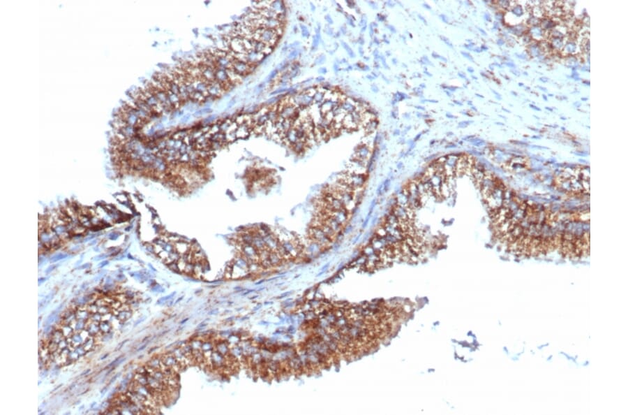 Immunohistochemistry - Anti-PMEPA1 Antibody [PMEPA1/6421R] - BSA and Azide free (A252939) - Antibodies.com