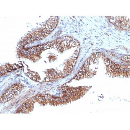 Immunohistochemistry - Anti-PMEPA1 Antibody [PMEPA1/6421R] - BSA and Azide free (A252939) - Antibodies.com