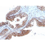 Immunohistochemistry - Anti-PMEPA1 Antibody [PMEPA1/6421R] - BSA and Azide free (A252939) - Antibodies.com