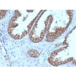 Immunohistochemistry - Anti-PMEPA1 Antibody [PMEPA1/6421R] - BSA and Azide free (A252938) - Antibodies.com