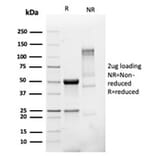 SDS-PAGE - Anti-PMEPA1 Antibody [PMEPA1/6421R] - BSA and Azide free (A252939) - Antibodies.com
