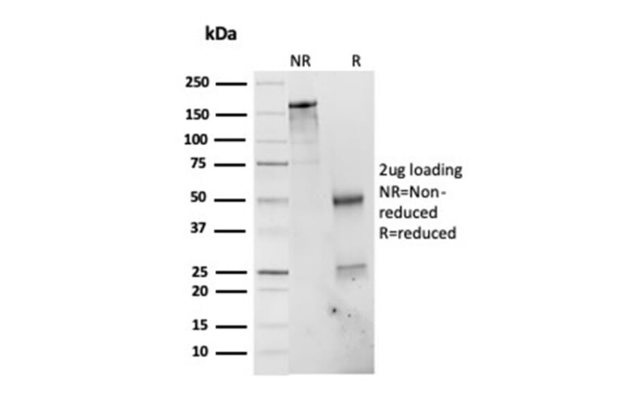 SDS-PAGE - Anti-PSMD4 Antibody [CPTC-PSMD4-3] - BSA and Azide free (A252940) - Antibodies.com