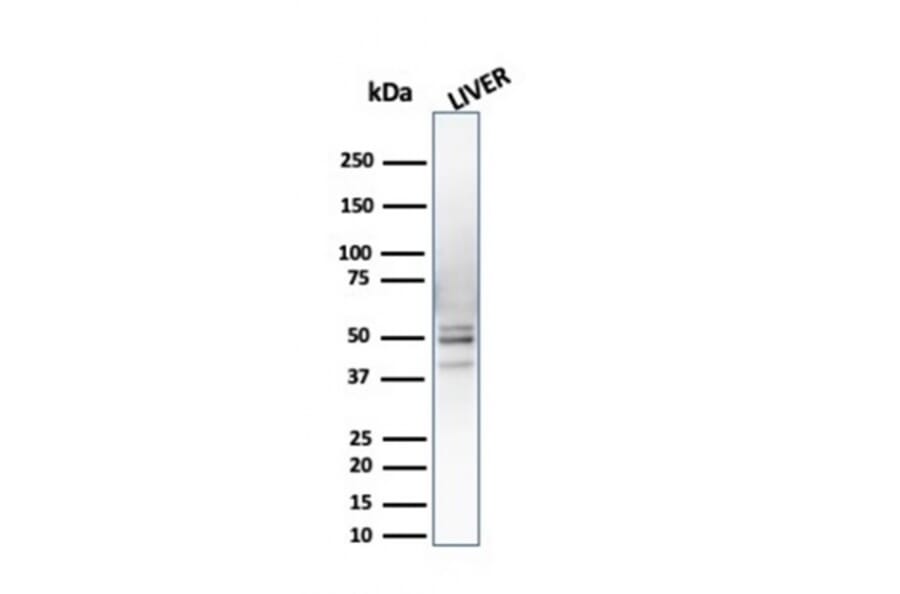 Western Blot - Anti-PSMD4 Antibody [CPTC-PSMD4-3] - BSA and Azide free (A252940) - Antibodies.com