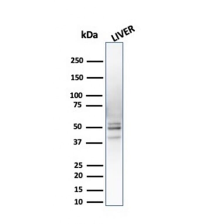 Western Blot - Anti-PSMD4 Antibody [CPTC-PSMD4-3] - BSA and Azide free (A252940) - Antibodies.com