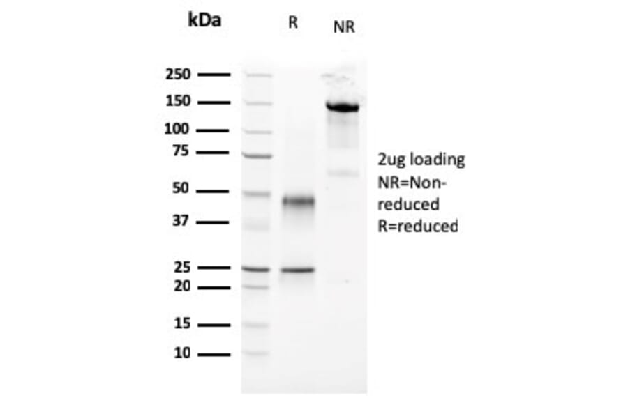 SDS-PAGE - Anti-Parathyroid Hormone Antibody [3H9] - BSA and Azide free (A252941) - Antibodies.com