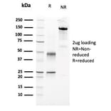 SDS-PAGE - Anti-Parathyroid Hormone Antibody [3H9] - BSA and Azide free (A252941) - Antibodies.com