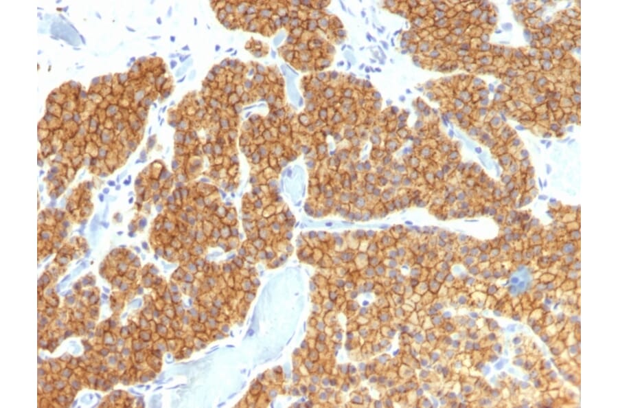 Immunohistochemistry - Anti-Parathyroid Hormone Antibody [PTH/911] - BSA and Azide free (A252942) - Antibodies.com