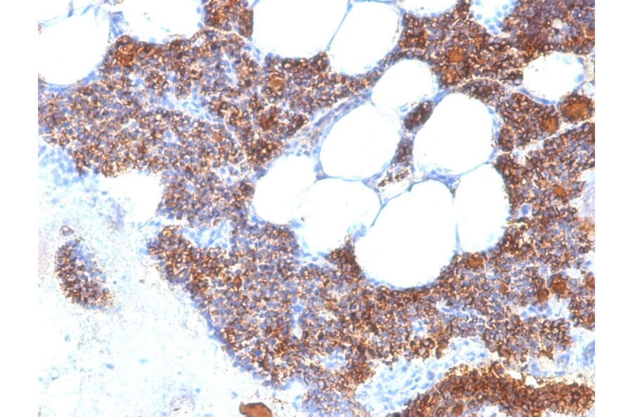 Immunohistochemistry - Anti-Parathyroid Hormone Antibody [SPM604] - BSA and Azide free (A252942) - Antibodies.com