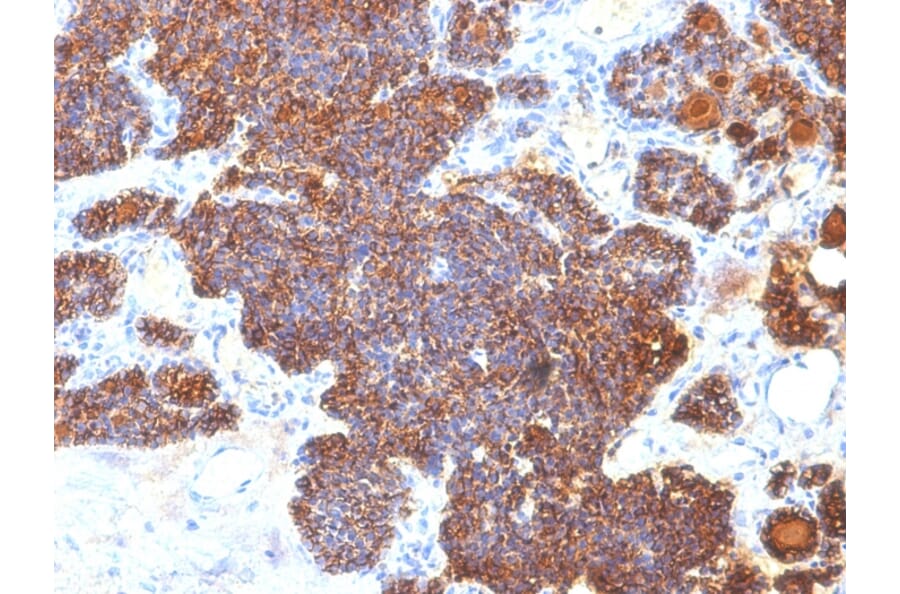 Immunohistochemistry - Anti-Parathyroid Hormone Antibody [PTH/1173] - BSA and Azide free (A252943) - Antibodies.com