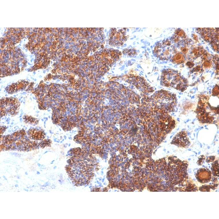 Immunohistochemistry - Anti-Parathyroid Hormone Antibody [PTH/1173] - BSA and Azide free (A252943) - Antibodies.com