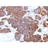 Immunohistochemistry - Anti-Parathyroid Hormone Antibody [PTH/1173] - BSA and Azide free (A252943) - Antibodies.com