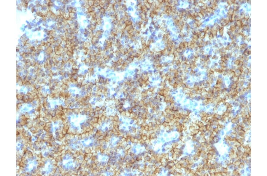 Immunohistochemistry - Anti-Parathyroid Hormone Antibody [PTH/1174] - BSA and Azide free (A252945) - Antibodies.com