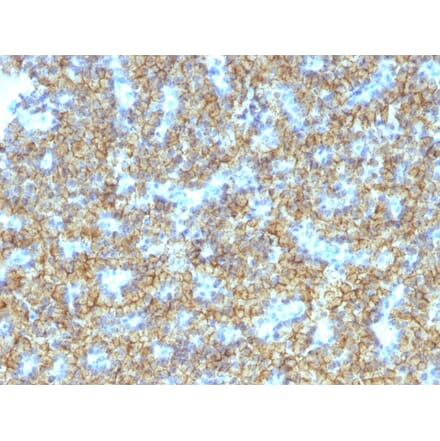 Immunohistochemistry - Anti-Parathyroid Hormone Antibody [PTH/1174] - BSA and Azide free (A252945) - Antibodies.com