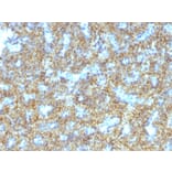 Immunohistochemistry - Anti-Parathyroid Hormone Antibody [PTH/1174] - BSA and Azide free (A252945) - Antibodies.com