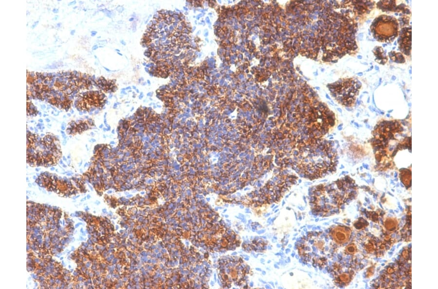 Immunohistochemistry - Anti-Parathyroid Hormone Antibody [PTH/1174] - BSA and Azide free (A252944) - Antibodies.com