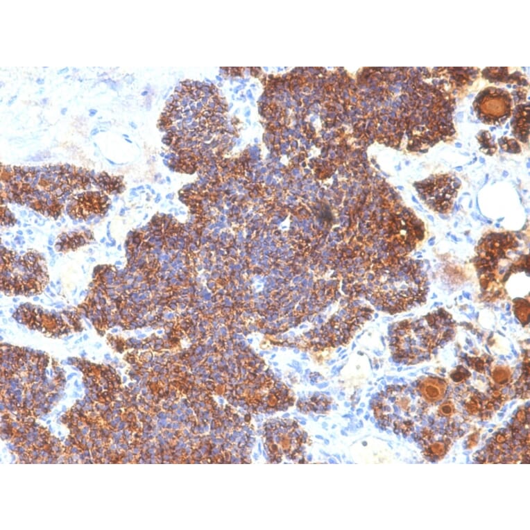 Immunohistochemistry - Anti-Parathyroid Hormone Antibody [PTH/1174] - BSA and Azide free (A252944) - Antibodies.com