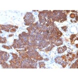 Immunohistochemistry - Anti-Parathyroid Hormone Antibody [PTH/1174] - BSA and Azide free (A252944) - Antibodies.com