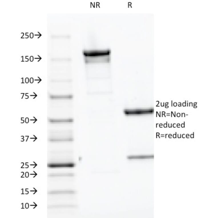 SDS-PAGE - Anti-Parathyroid Hormone Antibody [PTH/1174] - BSA and Azide free (A252945) - Antibodies.com