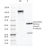 SDS-PAGE - Anti-Parathyroid Hormone Antibody [PTH/1174] - BSA and Azide free (A252945) - Antibodies.com