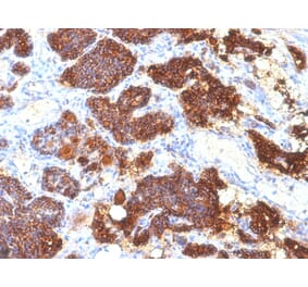 Immunohistochemistry - Anti-Parathyroid Hormone Antibody [PTH/1175] - BSA and Azide free (A252946) - Antibodies.com