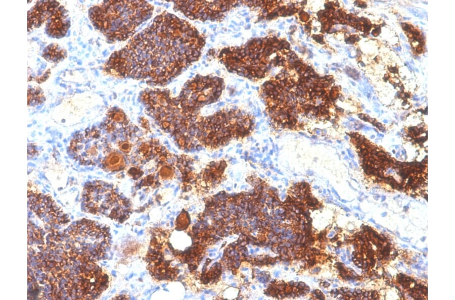 Immunohistochemistry - Anti-Parathyroid Hormone Antibody [PTH/1175] - BSA and Azide free (A252946) - Antibodies.com