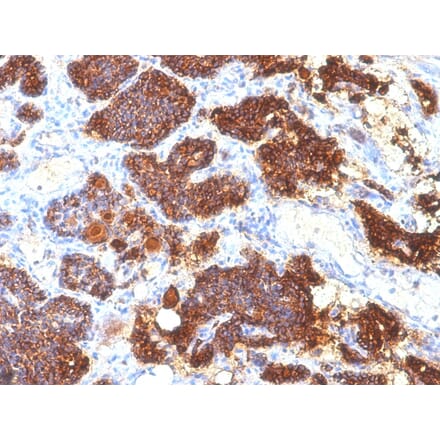 Immunohistochemistry - Anti-Parathyroid Hormone Antibody [PTH/1175] - BSA and Azide free (A252946) - Antibodies.com