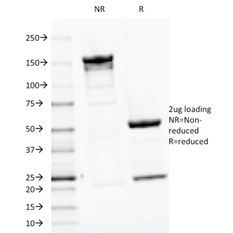 SDS-PAGE - Anti-Parathyroid Hormone Antibody [PTH/1175] - BSA and Azide free (A252946) - Antibodies.com