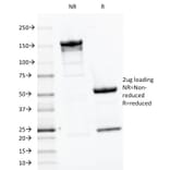 SDS-PAGE - Anti-Parathyroid Hormone Antibody [PTH/1175] - BSA and Azide free (A252946) - Antibodies.com
