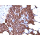 Immunohistochemistry - Anti-Parathyroid Hormone Antibody [3H9 + PTH/1175] - BSA and Azide free (A252946) - Antibodies.com