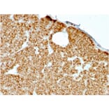 Immunohistochemistry - Anti-Parathyroid Hormone Antibody [rPTH/911] - BSA and Azide free (A252947) - Antibodies.com