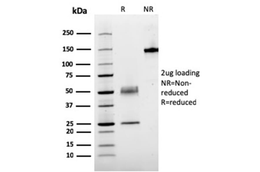 SDS-PAGE - Anti-Parathyroid Hormone Antibody [rPTH/911] - BSA and Azide free (A252948) - Antibodies.com