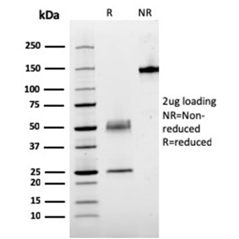SDS-PAGE - Anti-Parathyroid Hormone Antibody [rPTH/911] - BSA and Azide free (A252948) - Antibodies.com