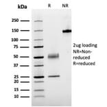 SDS-PAGE - Anti-Parathyroid Hormone Antibody [rPTH/911] - BSA and Azide free (A252948) - Antibodies.com