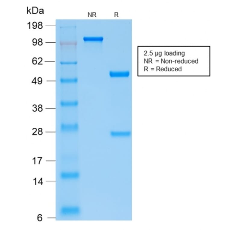 SDS-PAGE - Anti-Parathyroid Hormone Antibody [PTH/2295R] - BSA and Azide free (A252949) - Antibodies.com