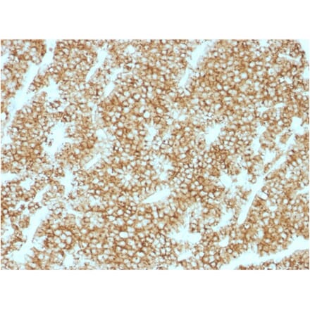 Immunohistochemistry - Anti-Parathyroid Hormone Antibody [PTH/1717R] - BSA and Azide free (A252949) - Antibodies.com